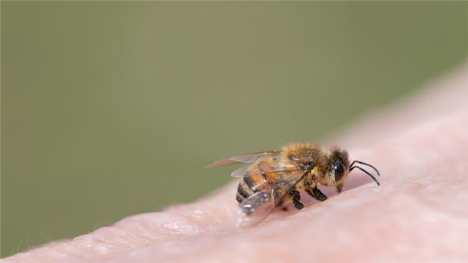 في حالة نادرة.. نحلة تلدغ رجلا في عينه وتترك مضاعفات خطيرة